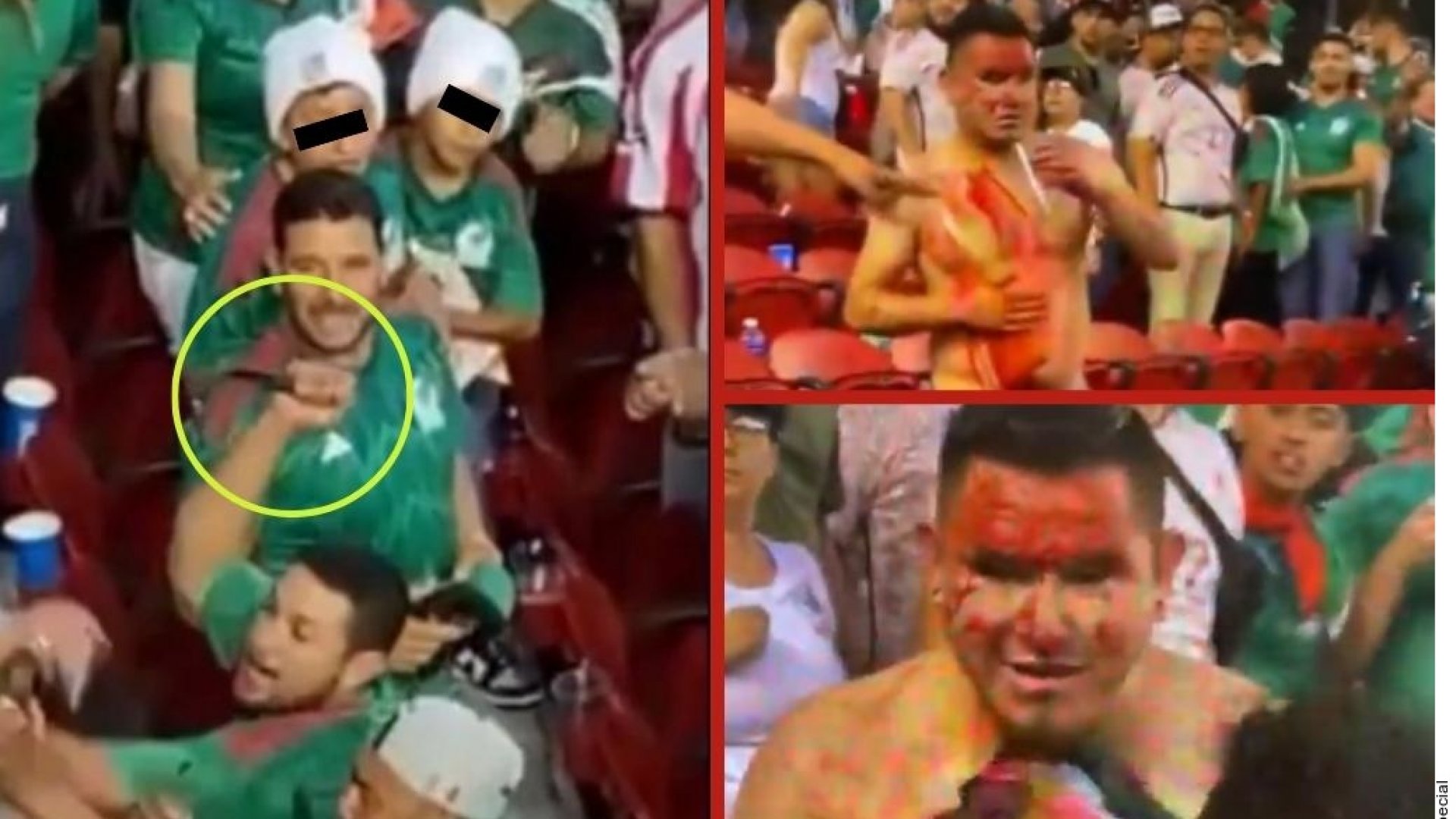 En situación crítica pero estable, lesionado en partido de México vs Qatar
