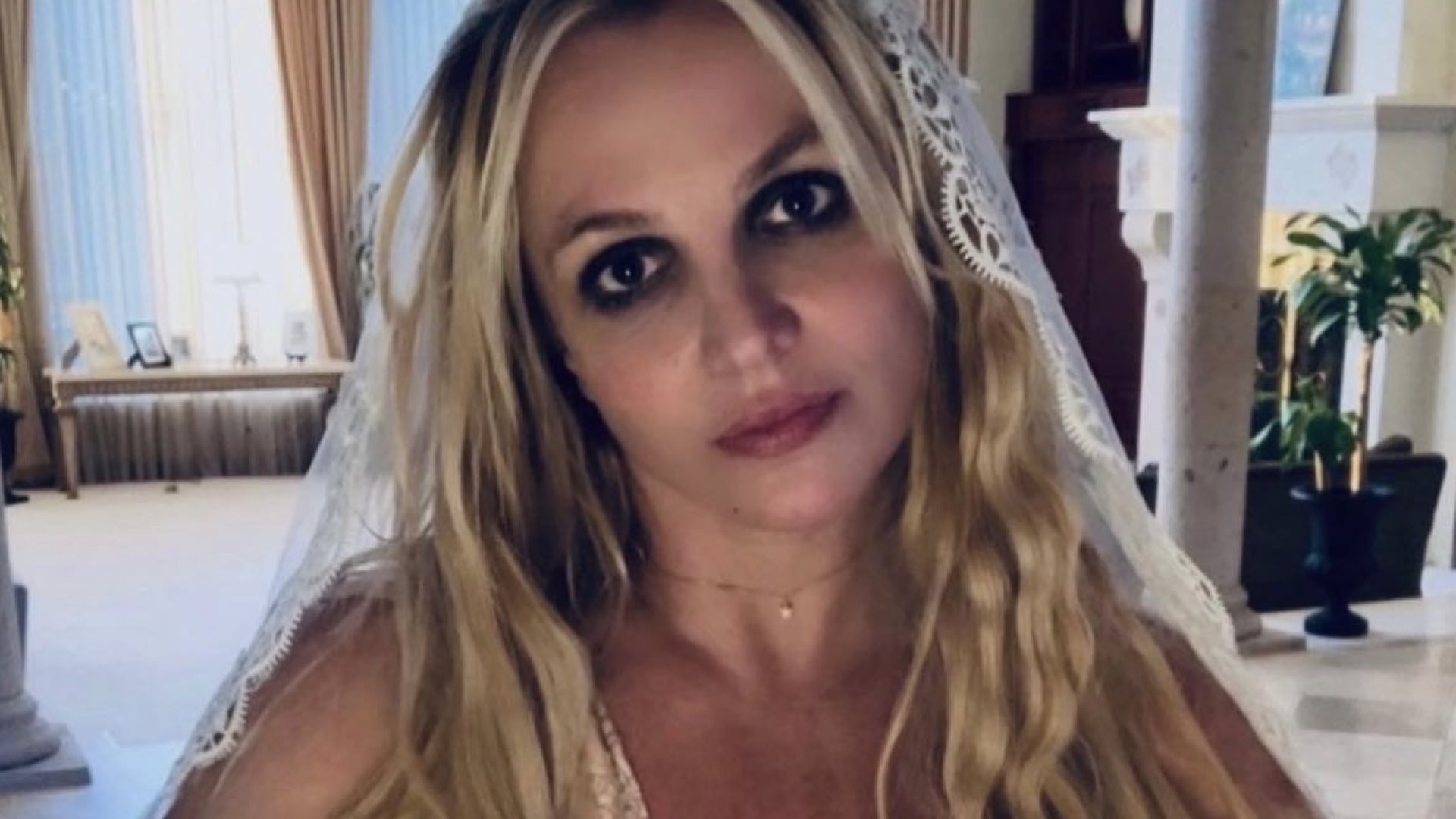Revela Britney Spears los daños que tuvo por usar botox 
