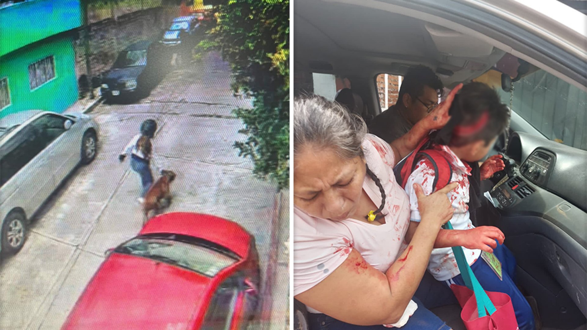 Pitbull ataca a niño en Morelos; lo hiere de gravedad