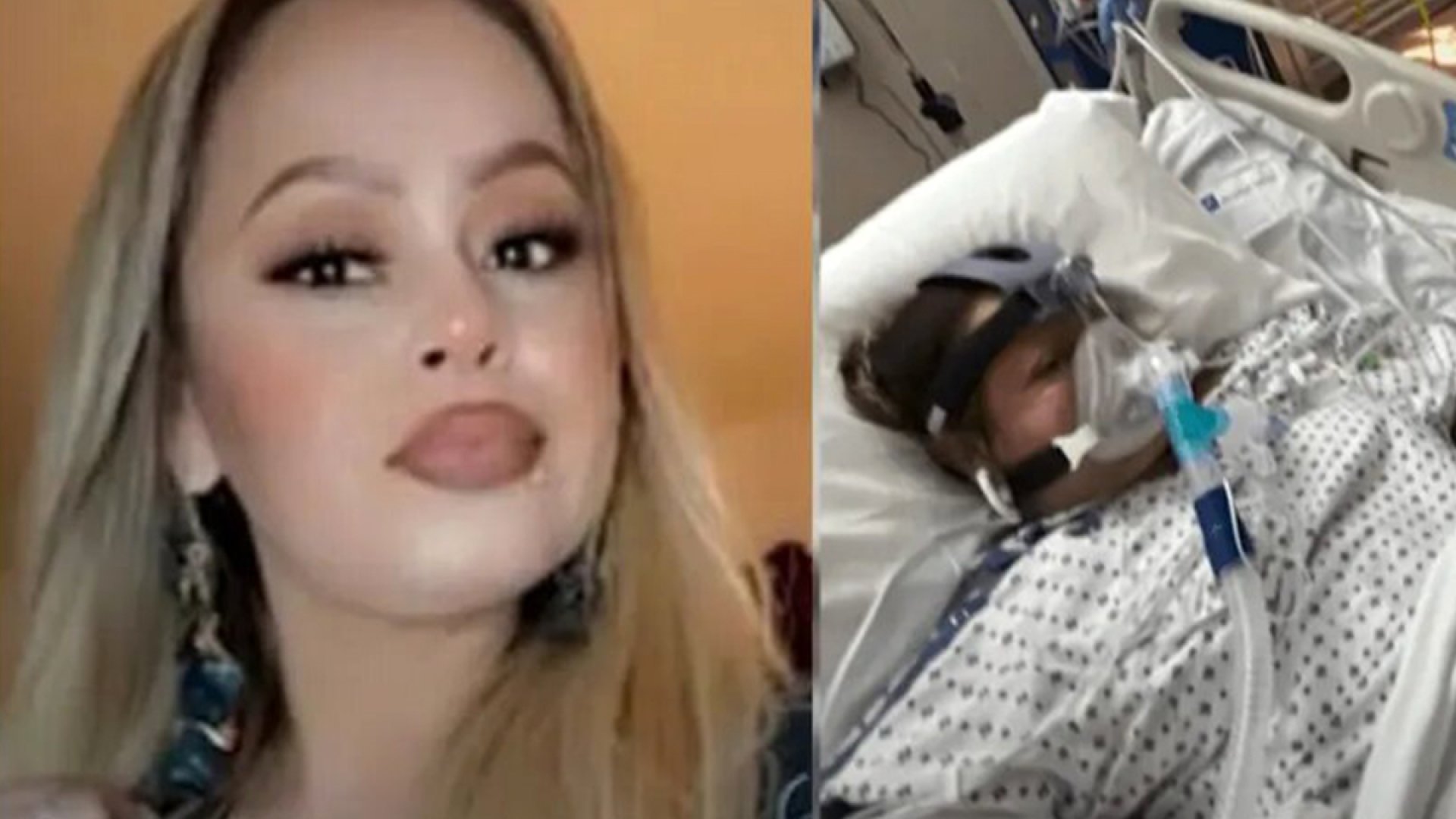 Mujer pierde brazos y piernas tras comer un filete de pescado infectado de mortal bacteria