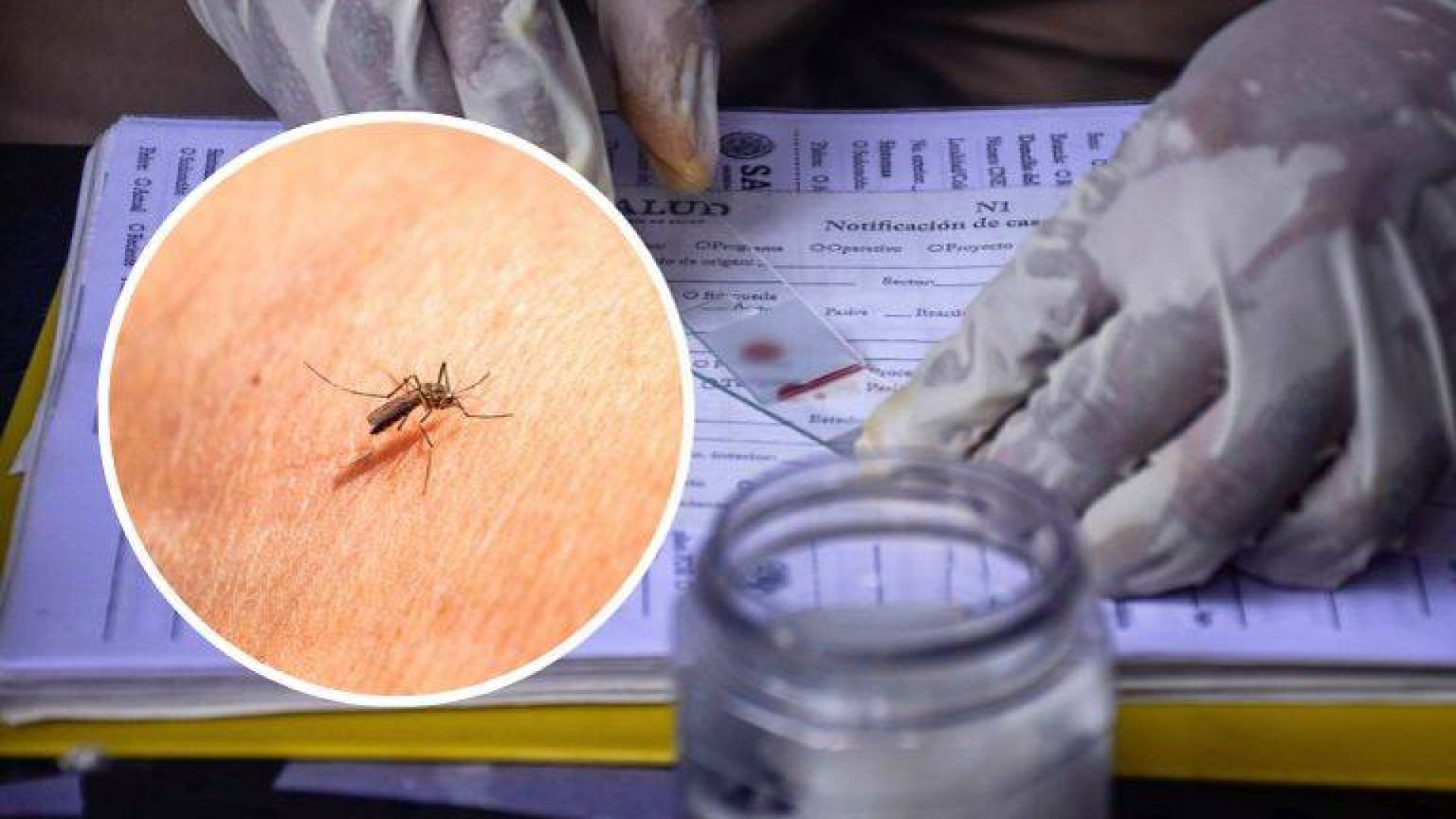 Alertan por casos de malaria entre migrantes en varias zonas del país