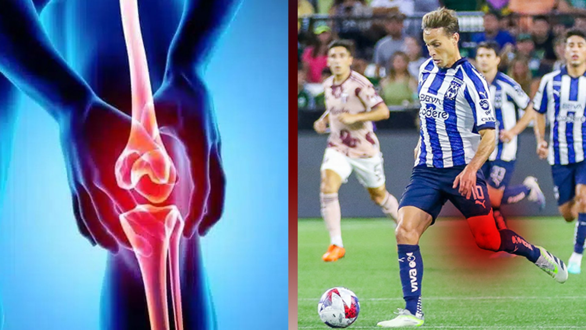 Sí operarán a Sergio Canales