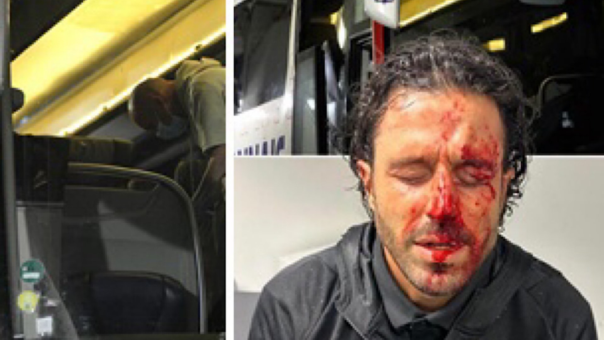 Suspenden en Francia el Marsella-Lyon tras agresiones al autobús visitante; el técnico Fabio Grosso resultó herido