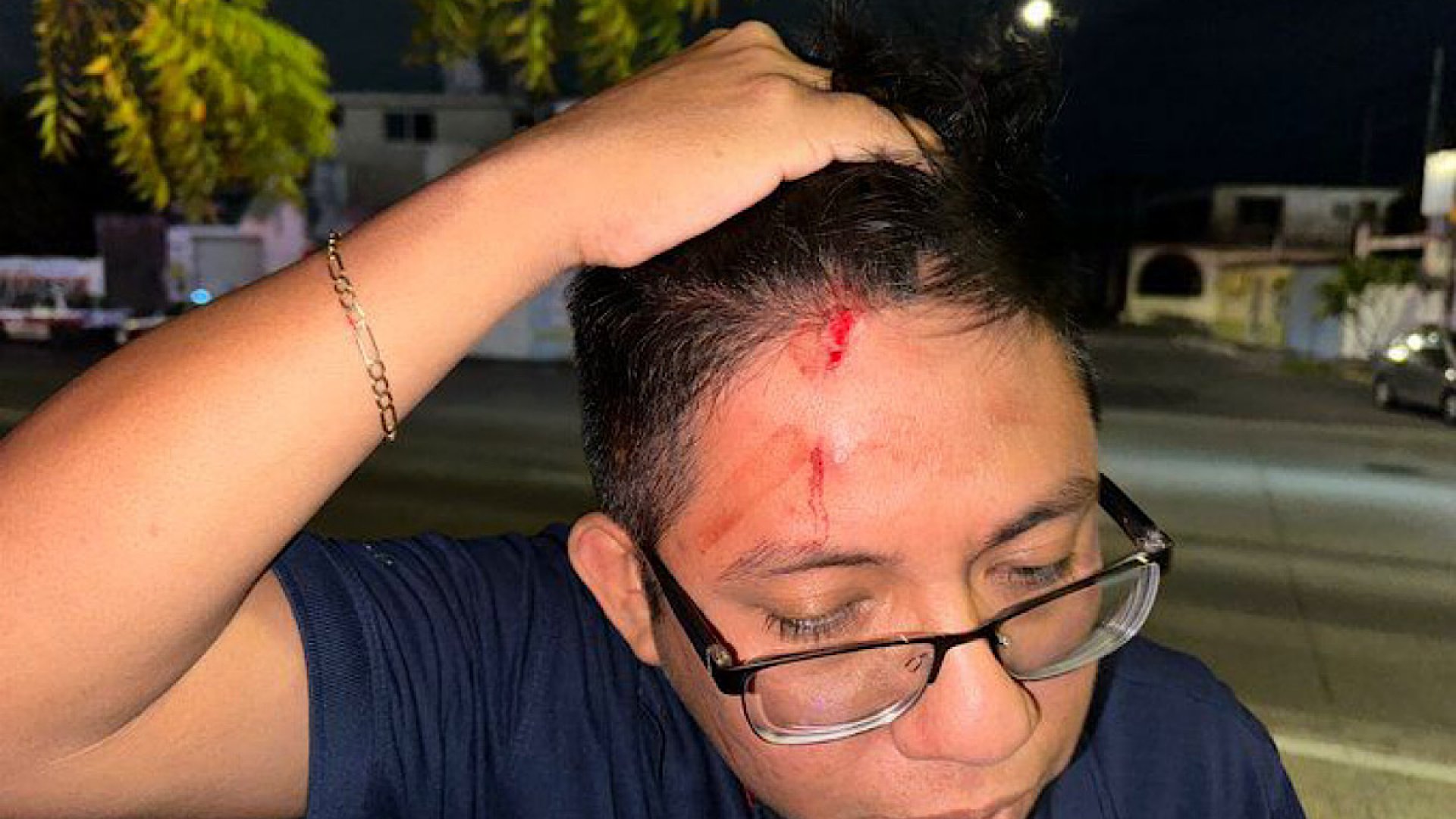 Policías agreden a reporteros durante cobertura de asalto en Veracruz