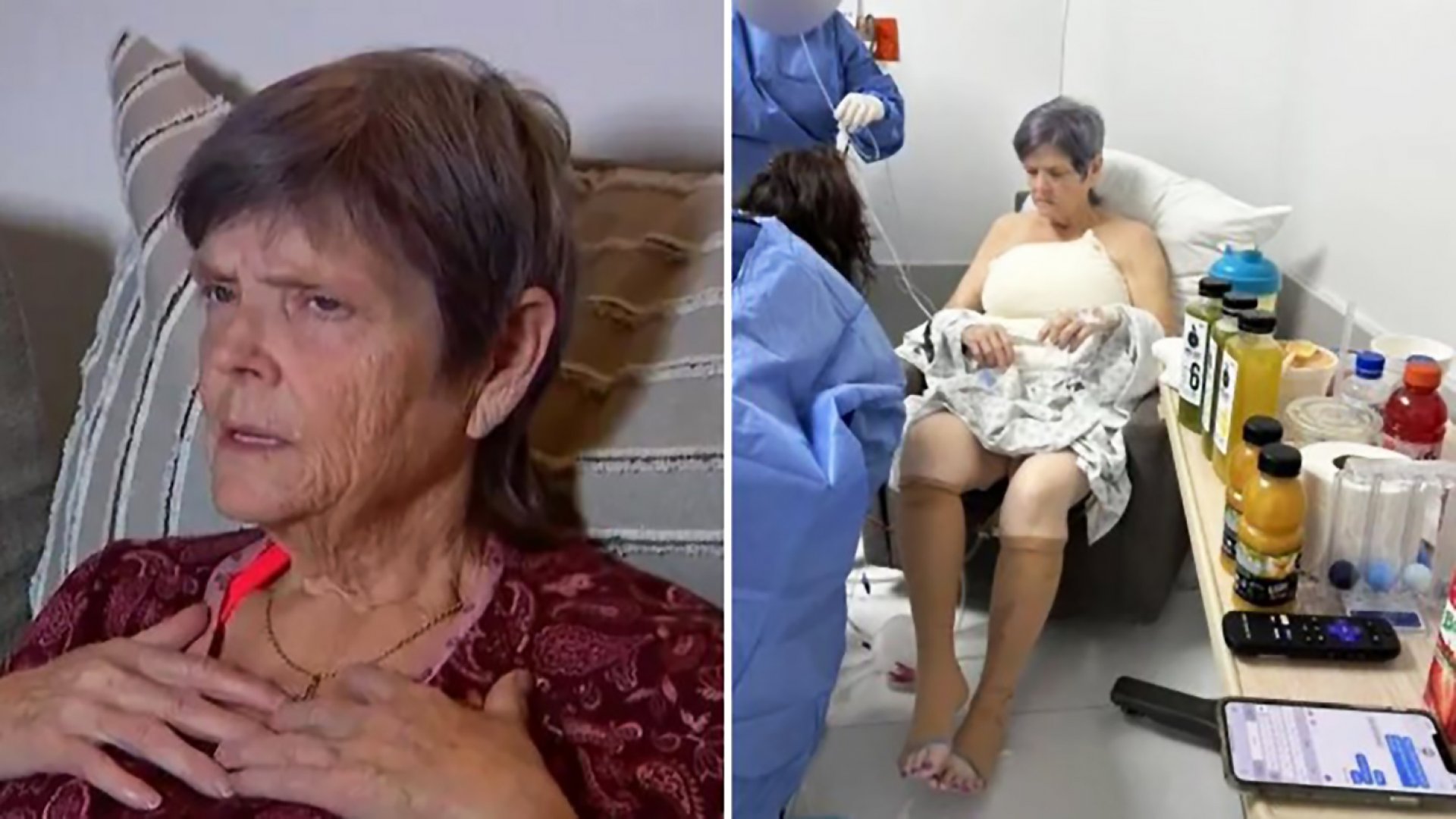 Viaja a México para cirugía de estiramiento; despierta con implantes y glúteos brasileños