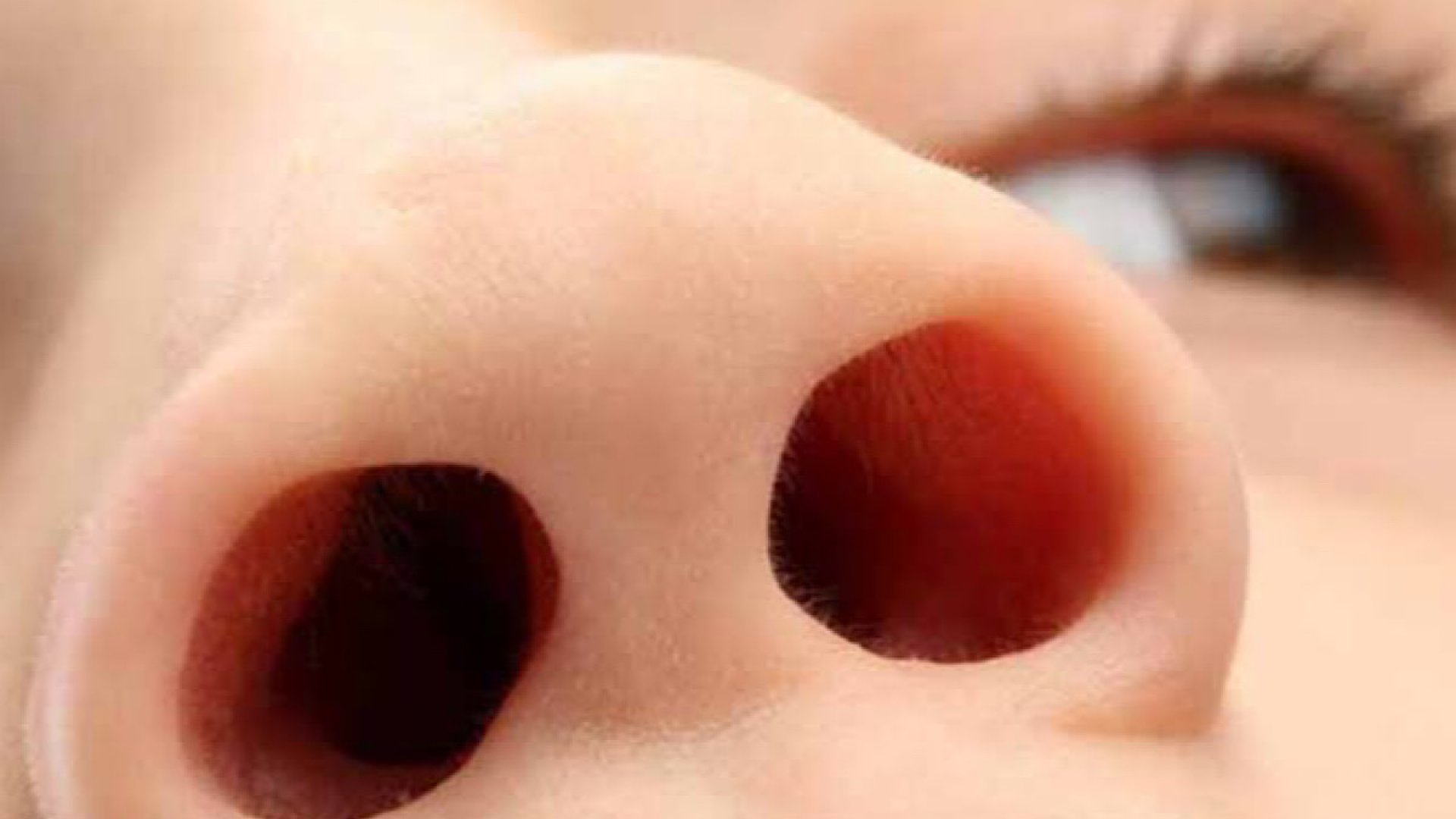 Alerta por incremento de casos del virus sincitial respiratorio