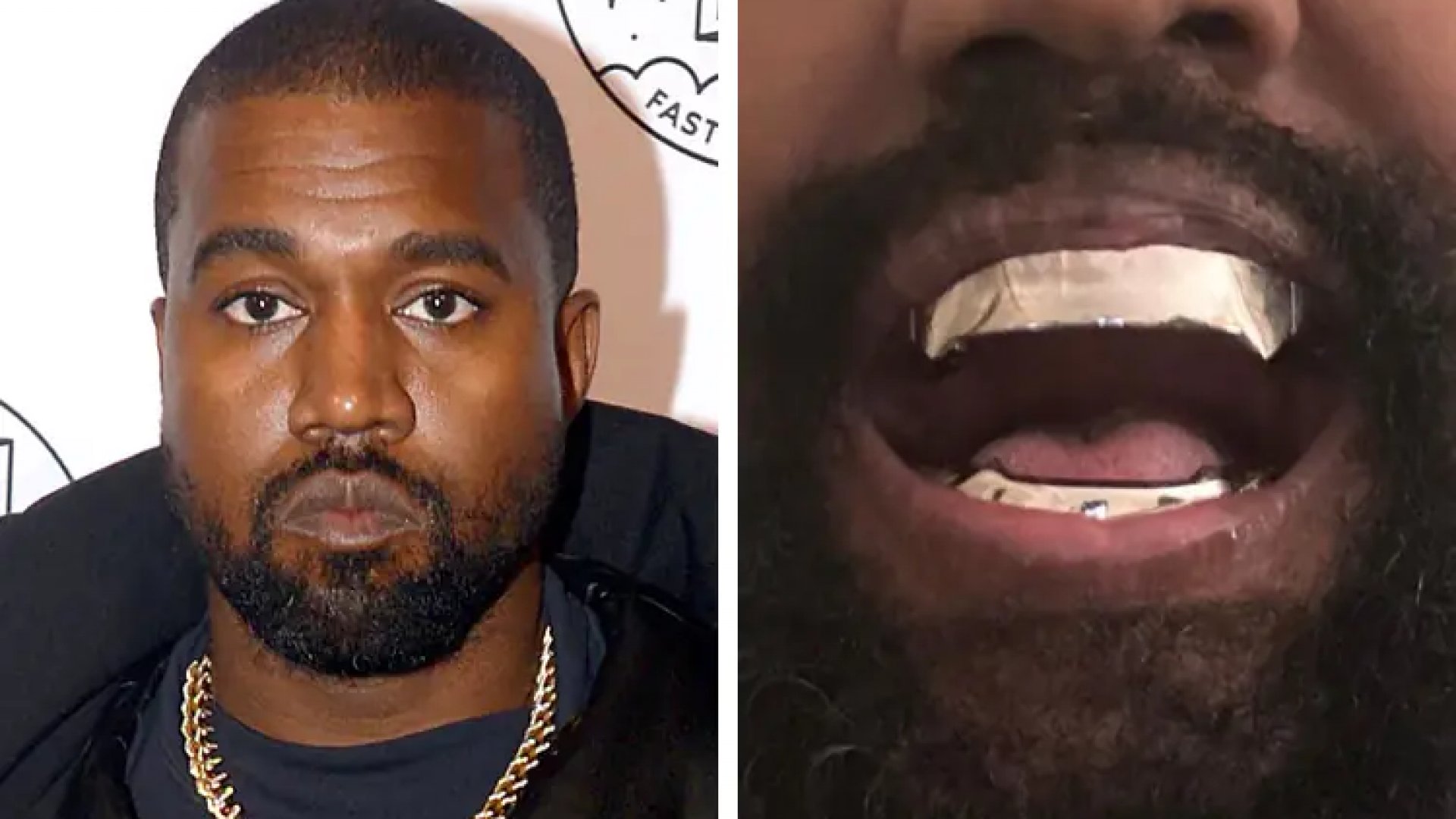 Presume Kanye West ¡dientes de titanio!