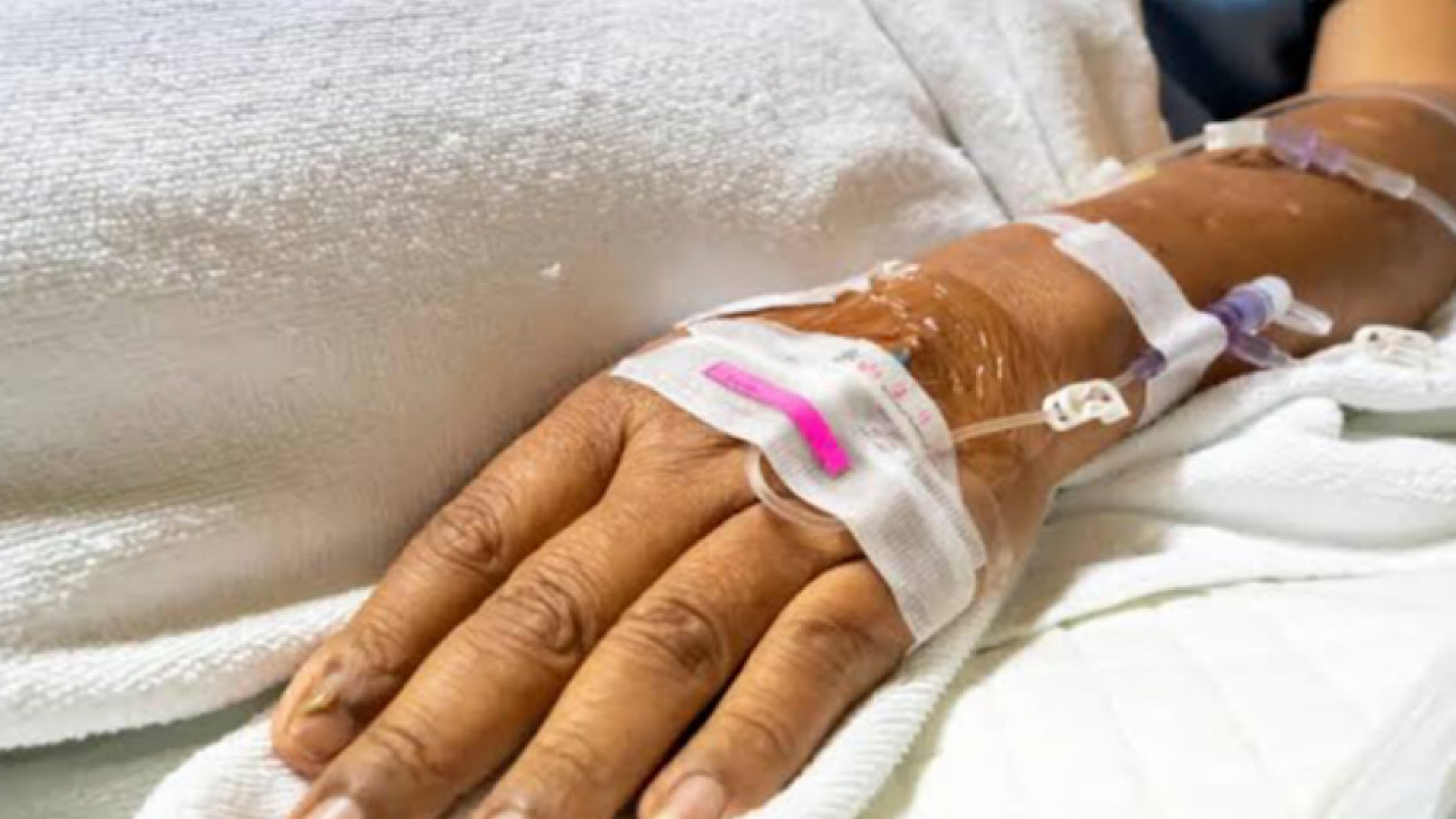 Reportan 4 muertes y 34 casos de síndrome de Guillain-Barré en Tlaxcala