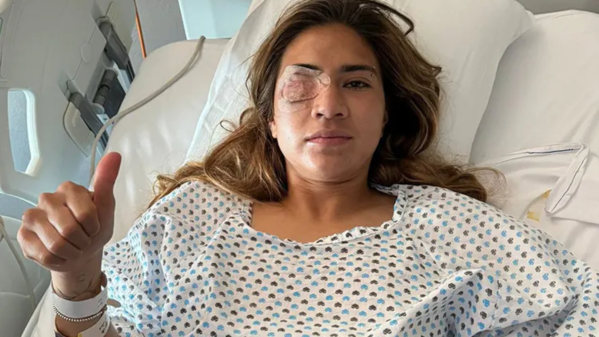 Queda Nayeli Rangel fuera del resto del Clausura 2024 tras fractura facial