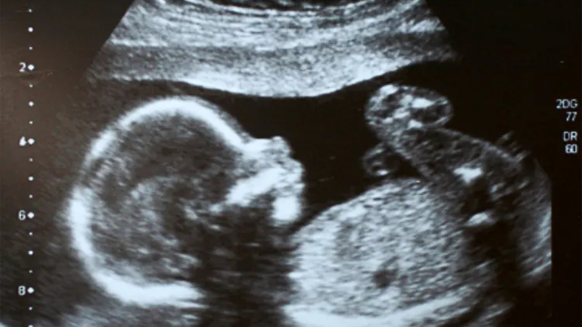 Por negarle aborto a niña de 12 años, colectivo exigen sancionar a funcionarios