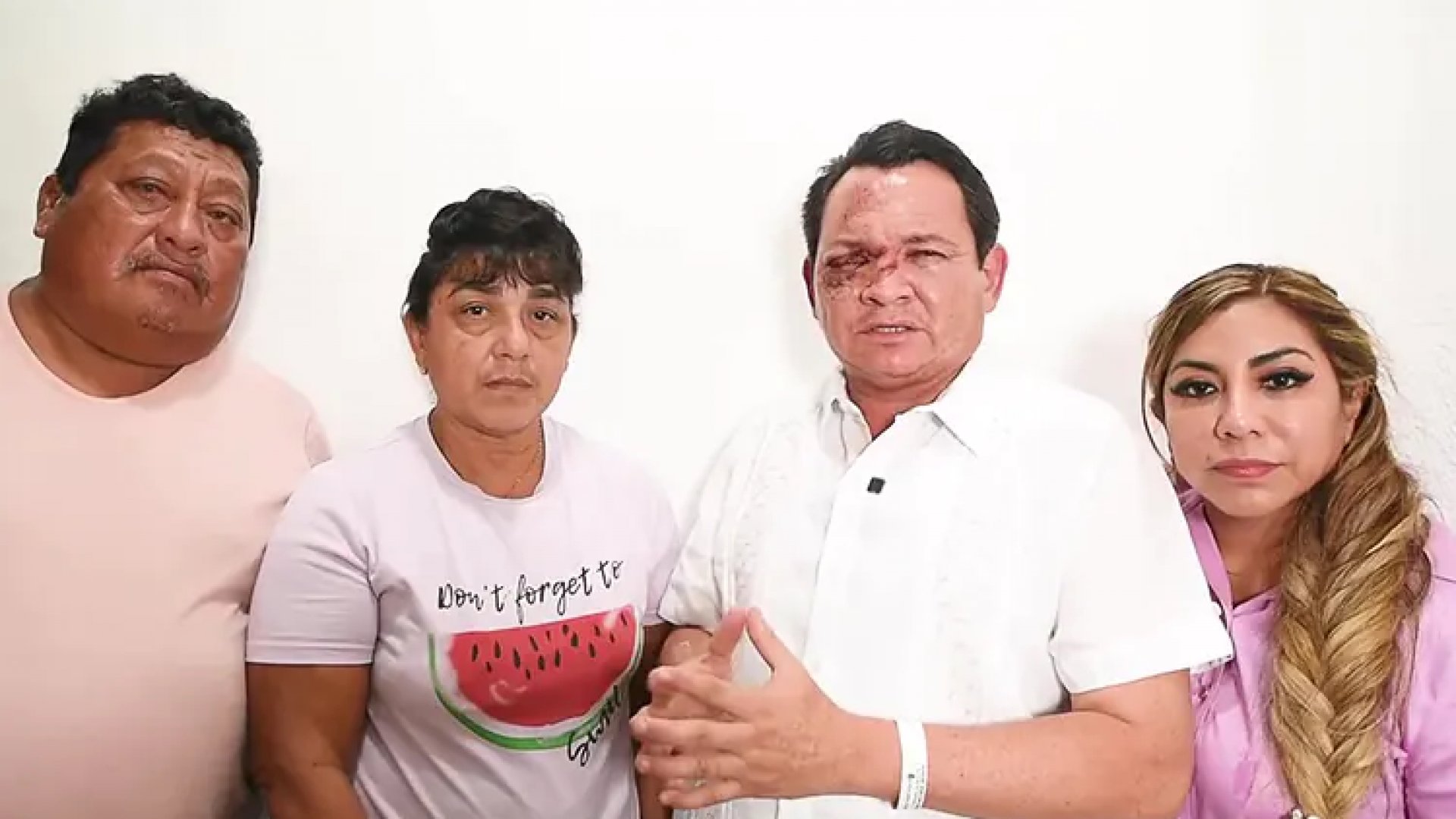 Dan de alta a ‘Huacho’ Díaz tras reconstrucción del ojo