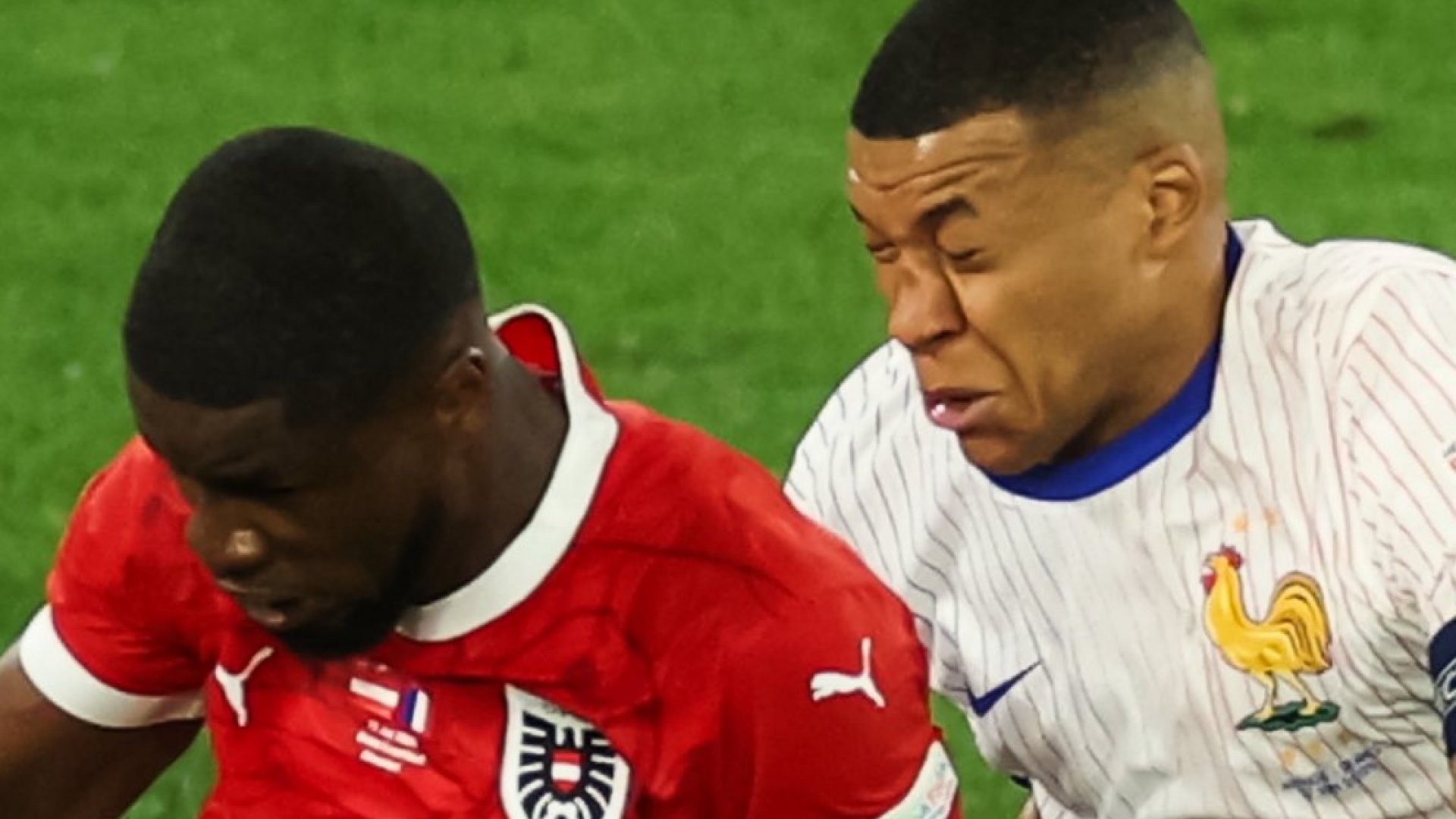 Mbappé sufre fractura de nariz y será operado en hospital de Dusseldorf