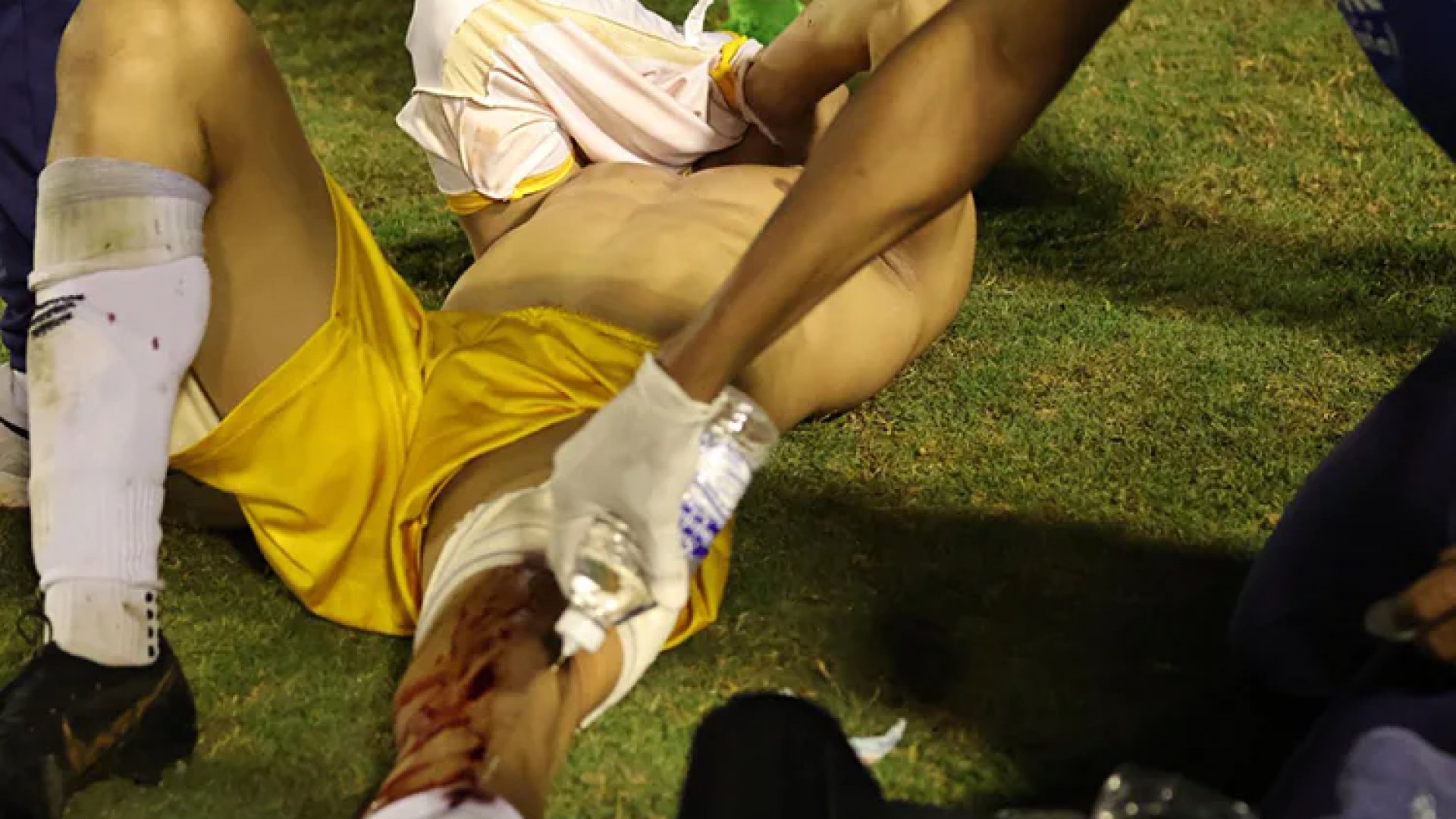 Le disparan a jugador brasileño en gresca futbolera | Video