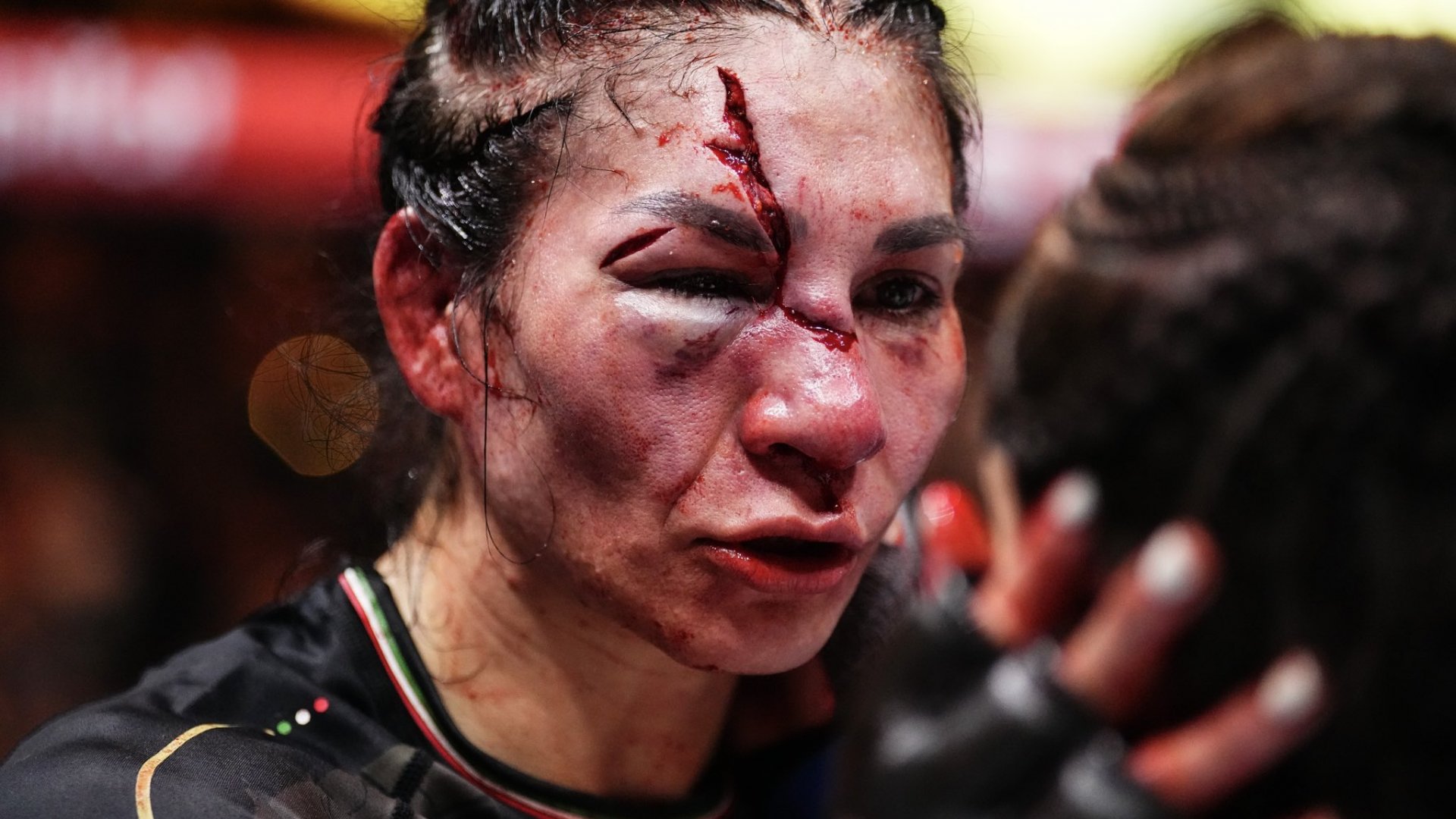 Video | Irene Aldana sufre brutal corte en el rostro en su derrota ante a Norma Dumont