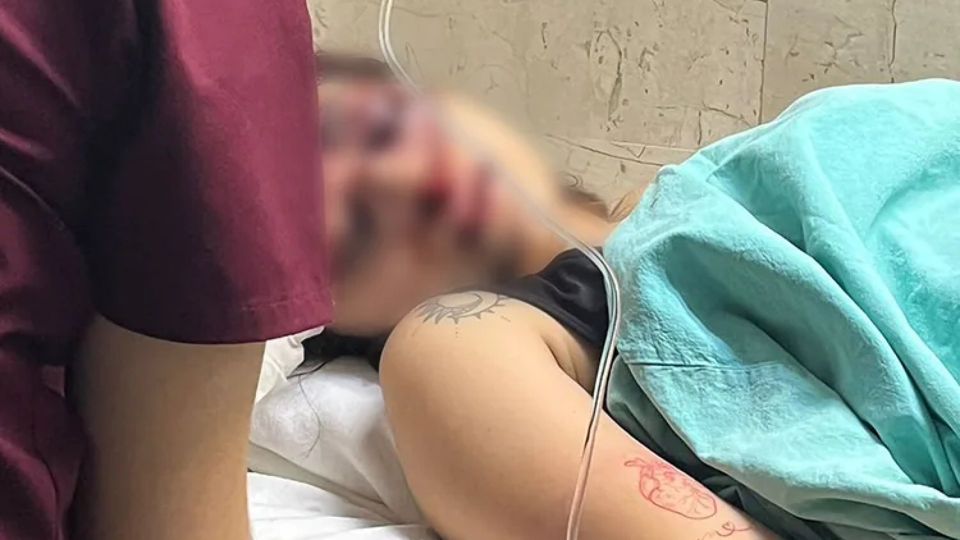 Operan de un ojo a Melanie, joven golpeada con brutalidad por su novio