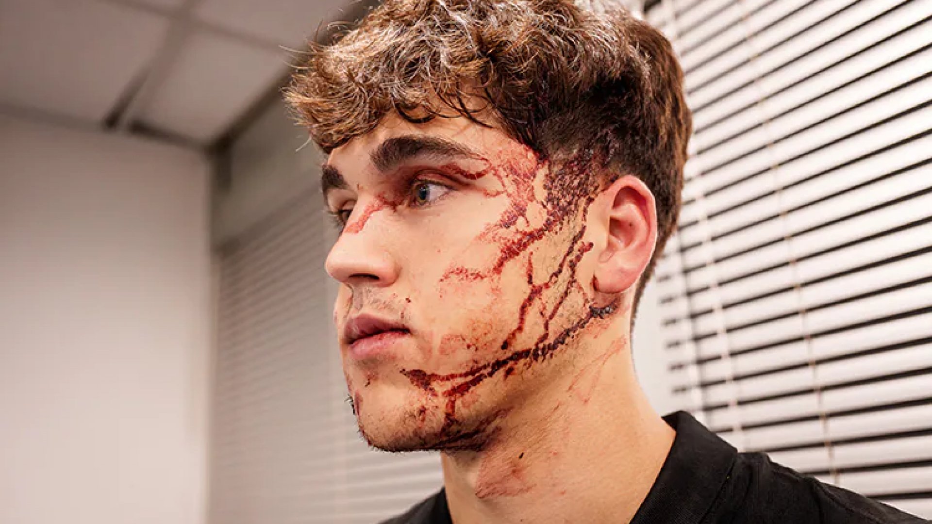 Barcelona pierde a Pau Cubarsí tras impactante golpe en el rostro