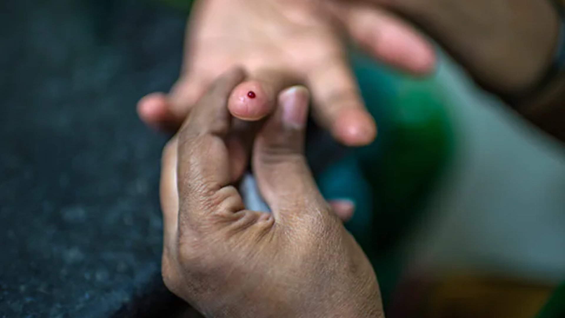 Padecen diabetes más de 800 millones de adultos en el mundo
