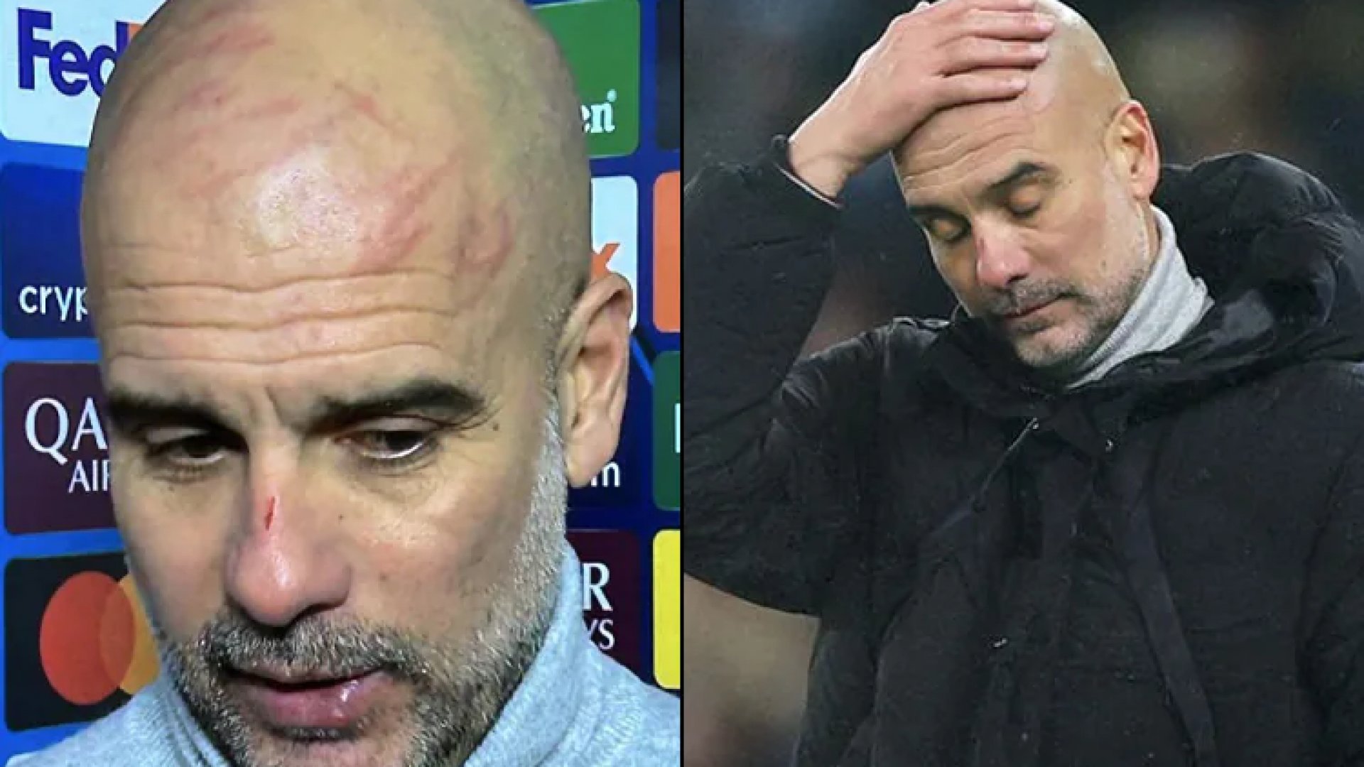 Pep Guardiola habla de autolesiones en la cabeza tras empate del Manchester City
