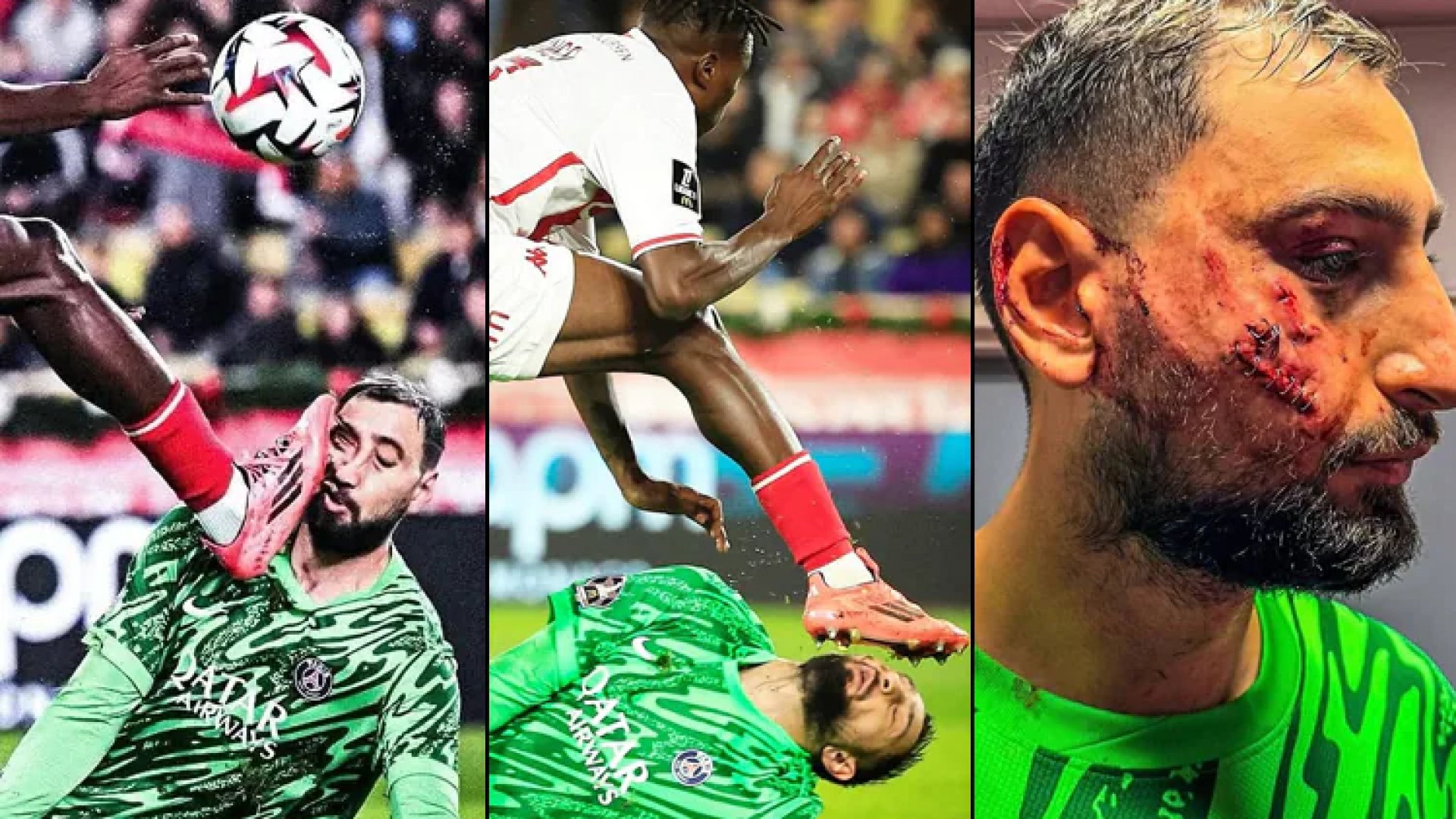 Monaco condena racismo contra Wilfried Singo tras patearle la cara a Donnarumm